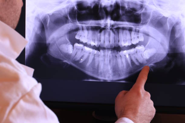 Best Emergency Dental Surgery in Pinckneyvle, IL