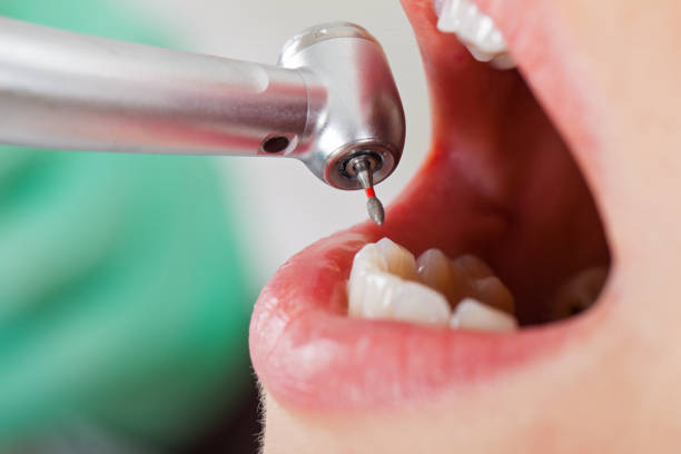 Best Urgent Dental Care in Pinckneyvle, IL